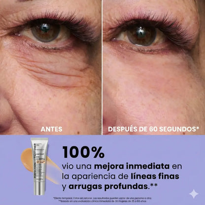 gel tensor de ojos